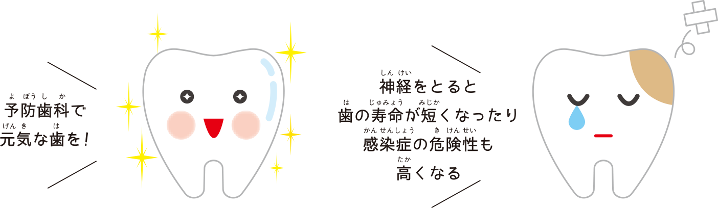 予防歯科で元気な歯を! 神経をとると歯の寿命が短くなったり感染症の危険性も高くなる